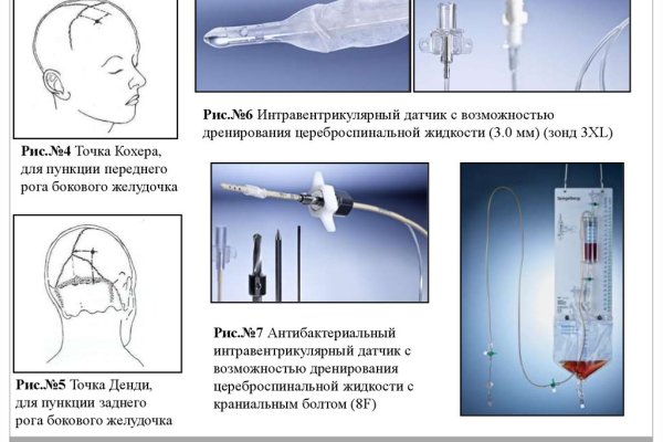 Кракен маркет что